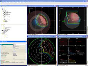 Panel systemu planowania leczenia Eclipse Ocular Proton Planning